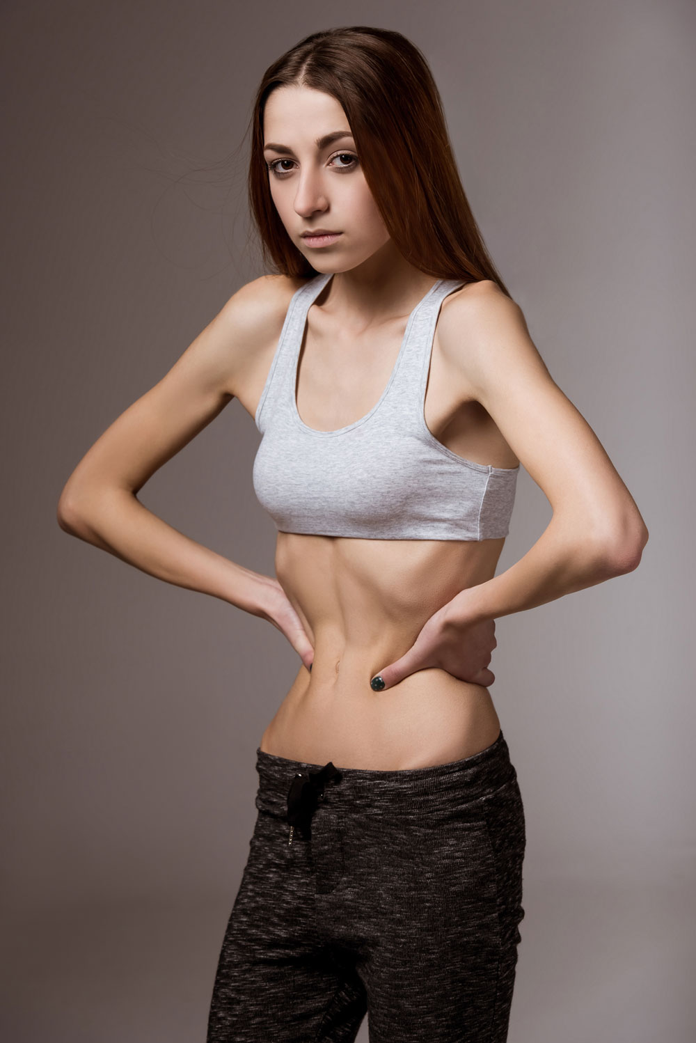 Anoreksiya Nervoza nedir